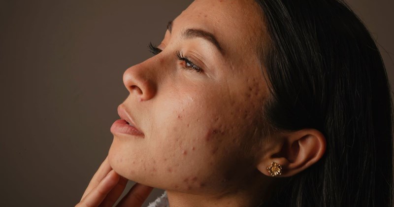  tweens marriage teenagers acne wife skin secrets teacher parenting husband sister in law wedding dad high school family daughter Reddit mom